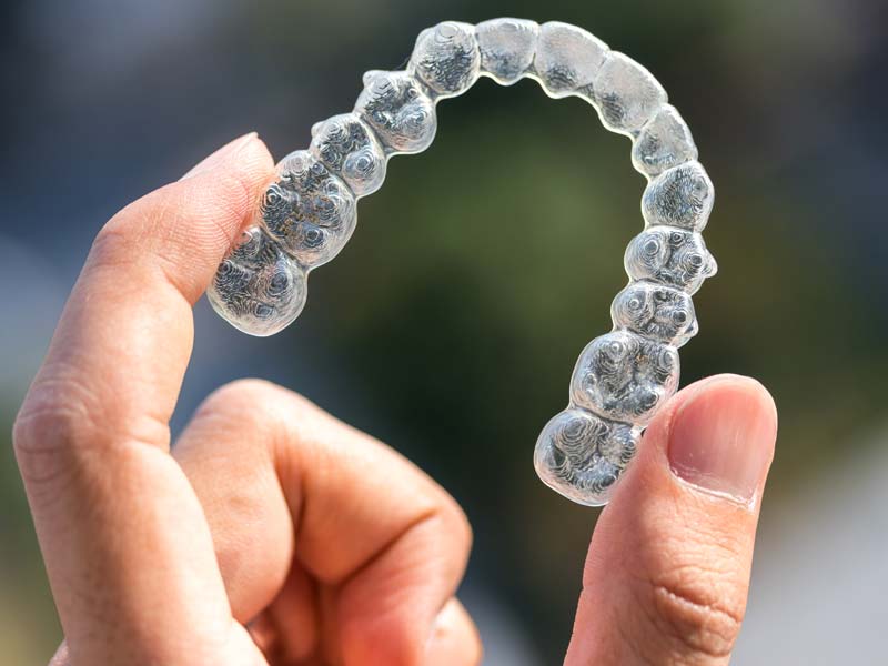 hand holding clear aligner