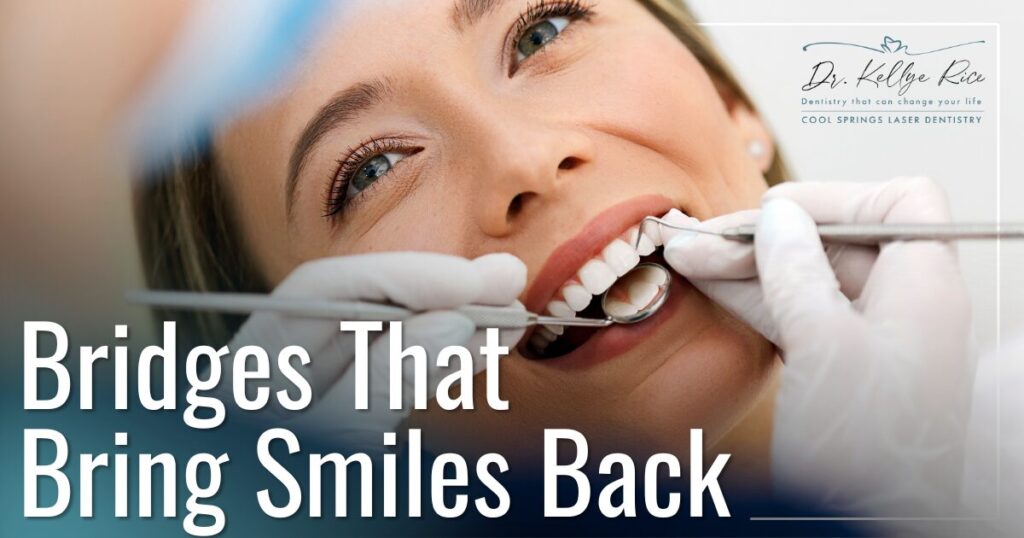 From Damaged to Dazzling: A Modern Look at Tooth Restoration with Crowns & Bridges