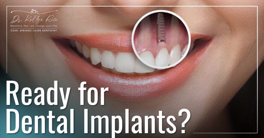 5 Signs You’re Ready for a Dental Implant